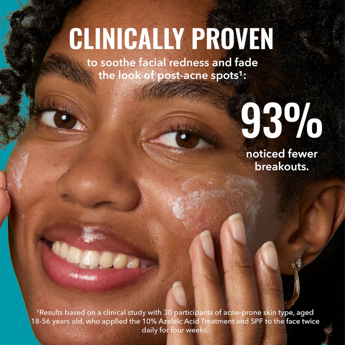 10-azelaic-acid-treatment-g7 zb_p.jpg