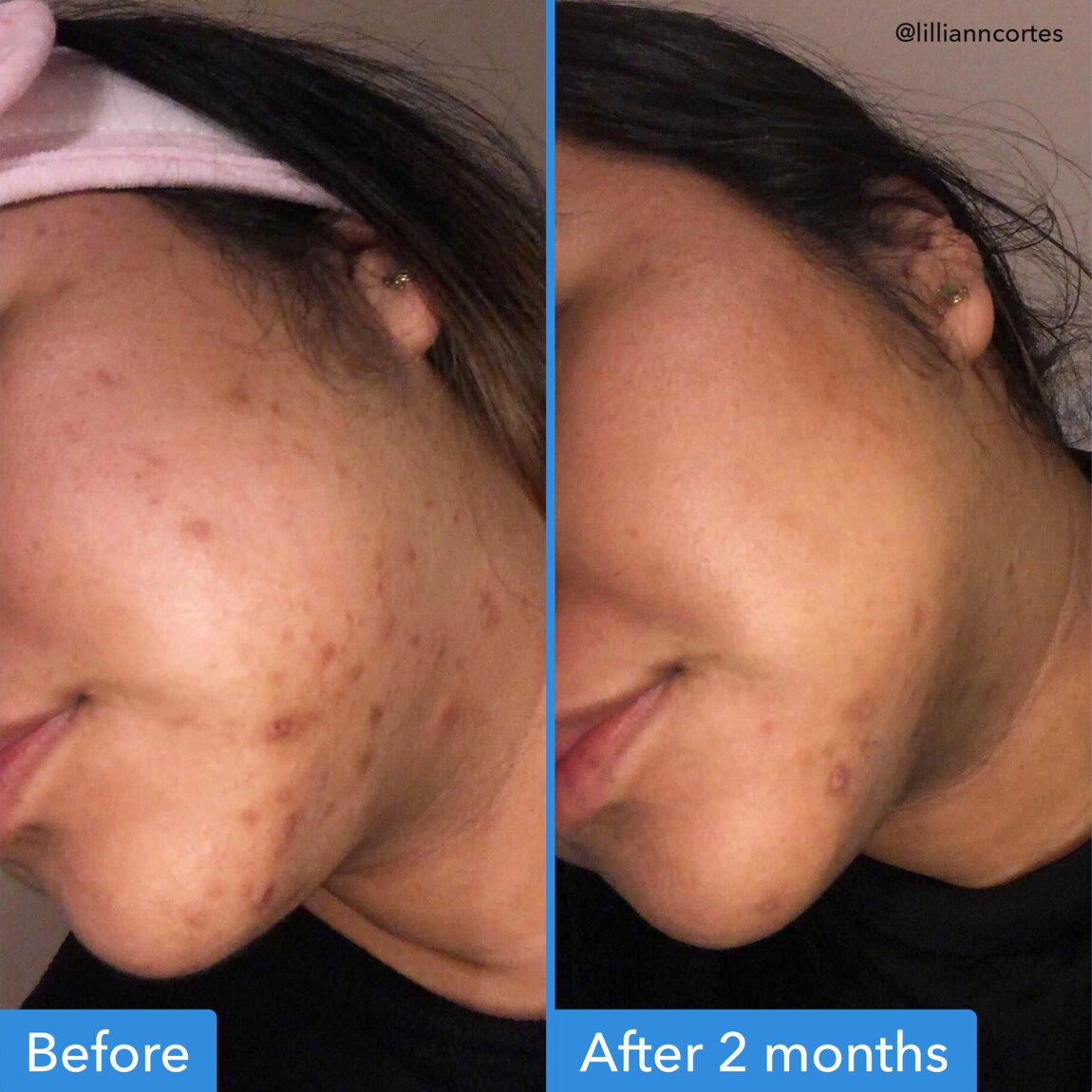 discoloration-correcting-serum-t3 zb_p.jpg