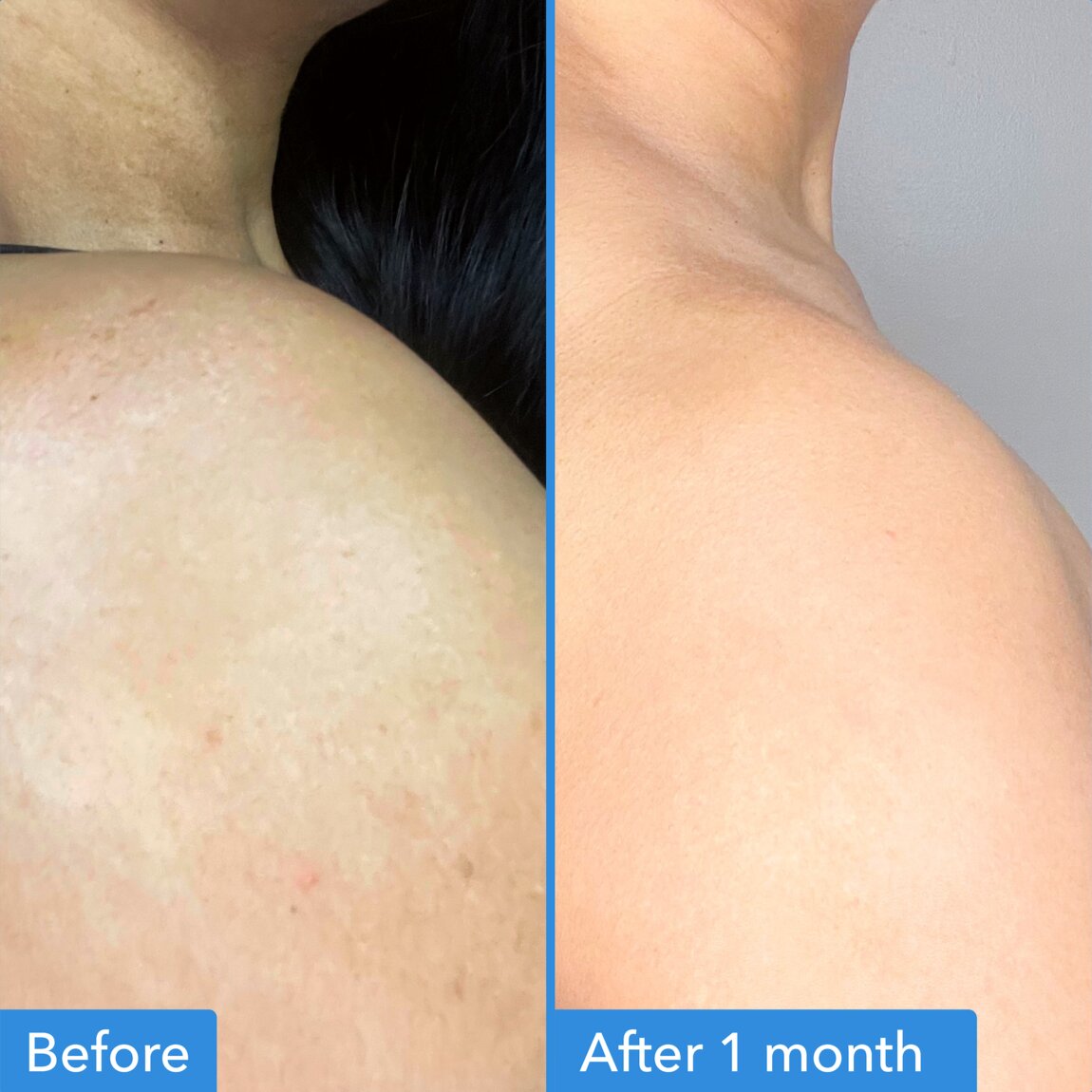 discoloration-correcting-body-treatment-x5 zb_p.jpg