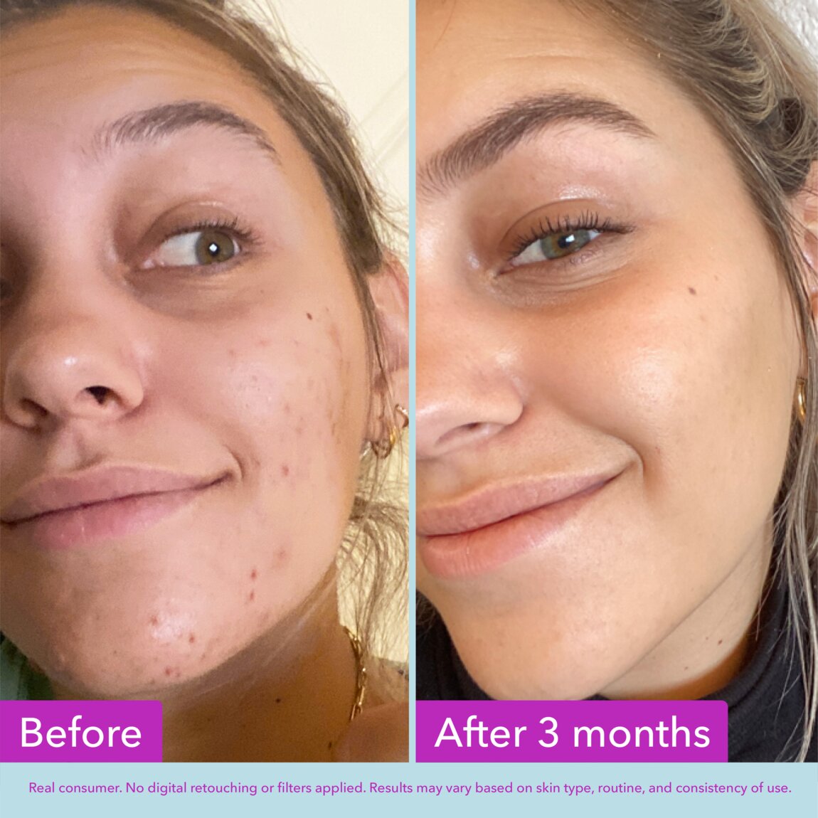 niacinamide-brightening-toner-f5 zb_p.jpg